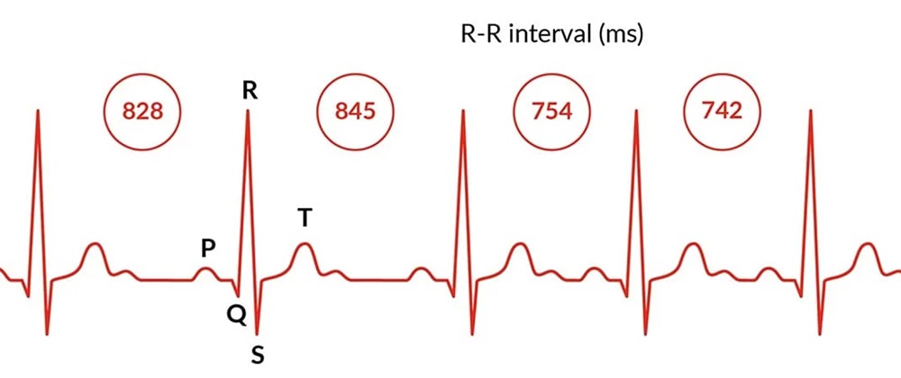Что такое вариабельность сердечного ритма